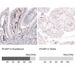 PLVAP Antibody, Novus Biologicals:Antibodies:Primary Antibodies